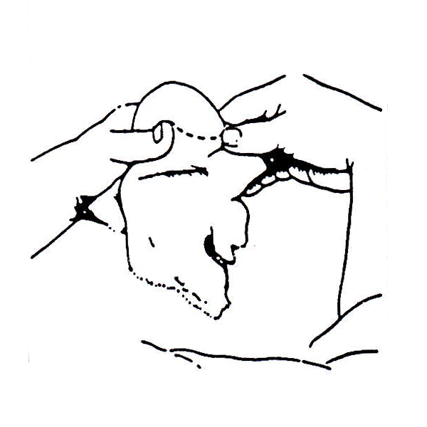 Fig-3.4